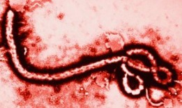 在线观看 伊波拉病毒,致命危机的全球追踪